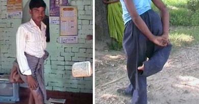 Indian Man Born With Four Legs Declared a Devil