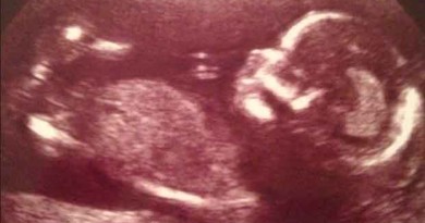 Ultrasound Shows "Spirit Duck" in the Womb With Baby
