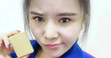 Girl Dumped for Being 'Fat' Gets Revenge by Sending Her Ex a Bar of Soap Made from Her Liposuctioned Fat